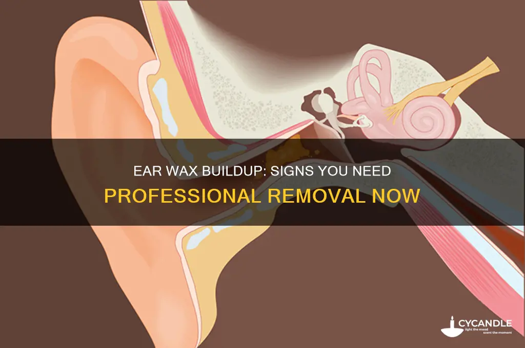 when do you need ear wax removal