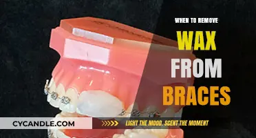 Braces Wax Removal: When and How to Safely Peel Off