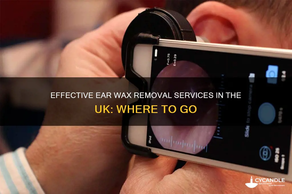 where can i get ear wax removal uk