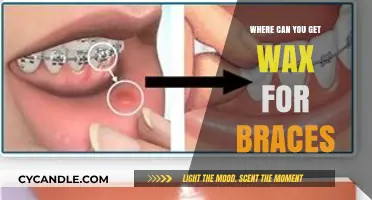 Where to Find Orthodontic Wax for Braces: A Comprehensive Guide