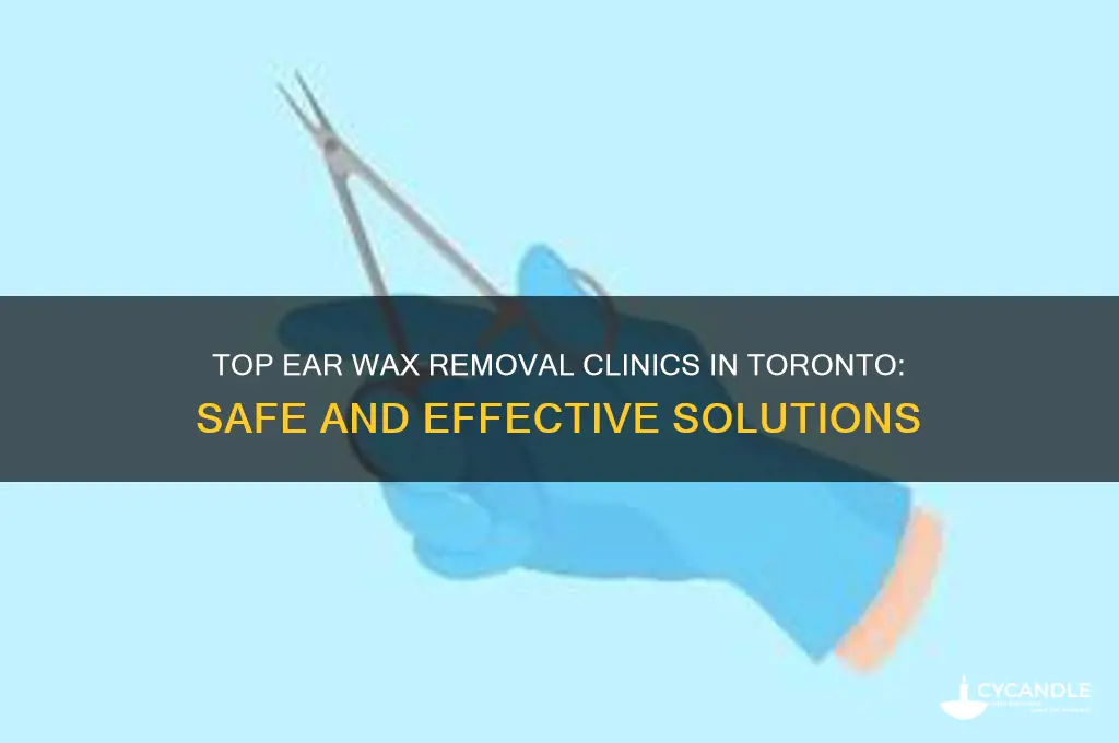where to get ear wax removal toronto