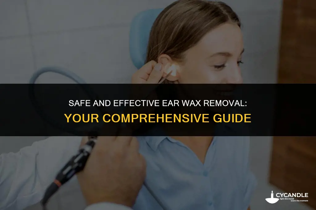 where to get ear wax removed