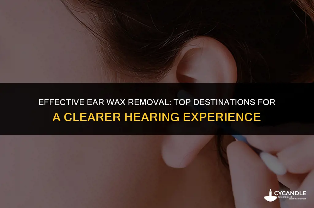 where to go to remove ear wax