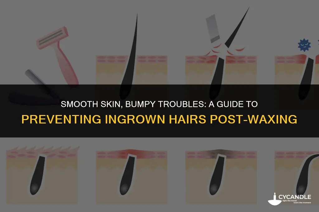 why am i getting so many ingrown hairs after waxing