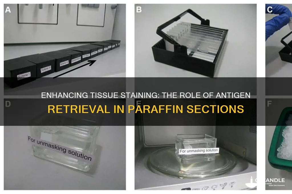 why antigen retrieval with paraffin