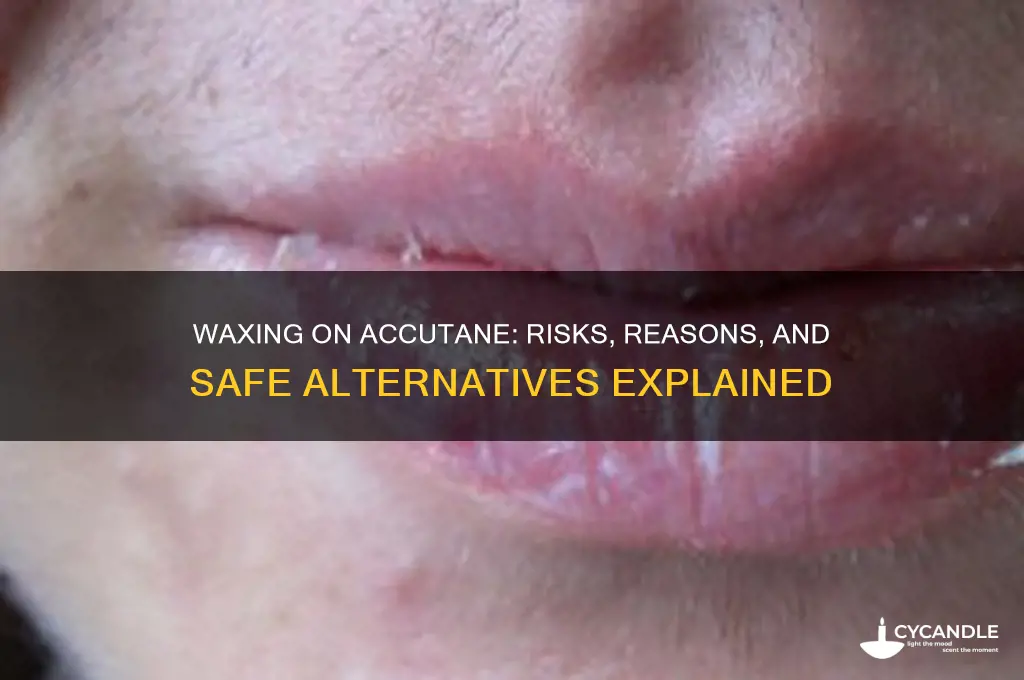 why can t you wax on accutane