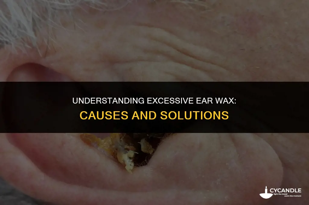 why do i get so much ear wax