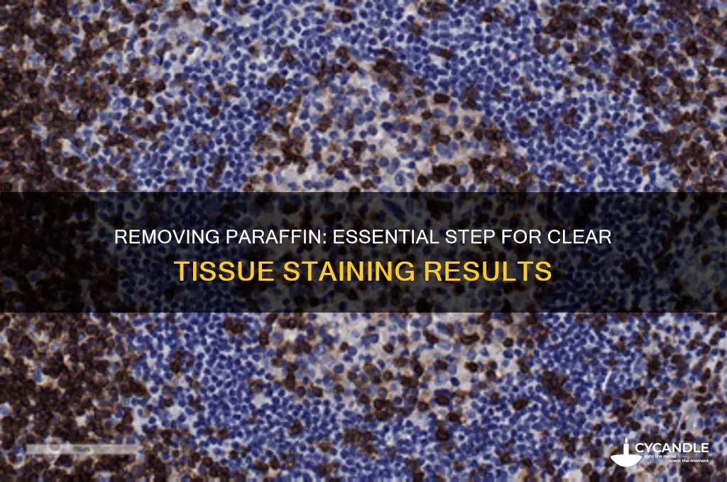 why do you remove paraffin before staining