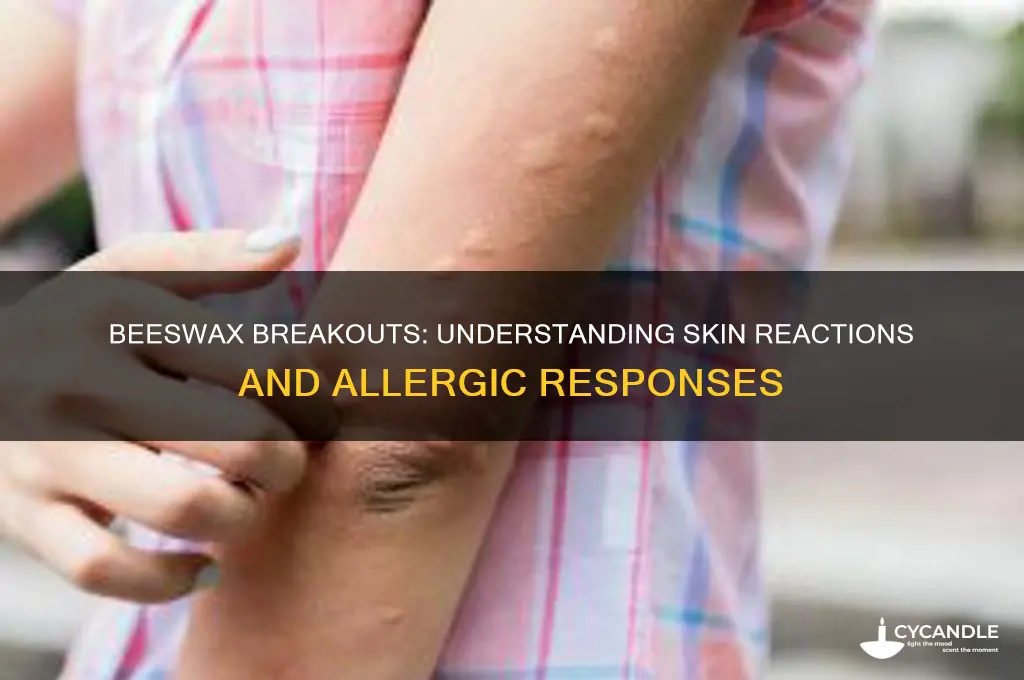 why does beeswax break me out