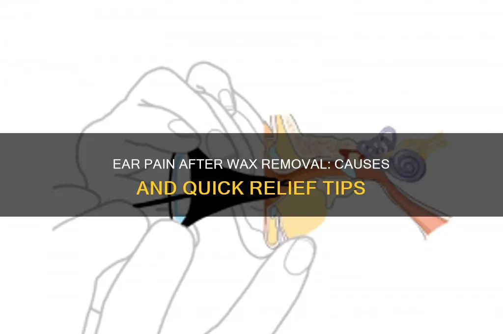 why does my ear hurt after ear wax removal