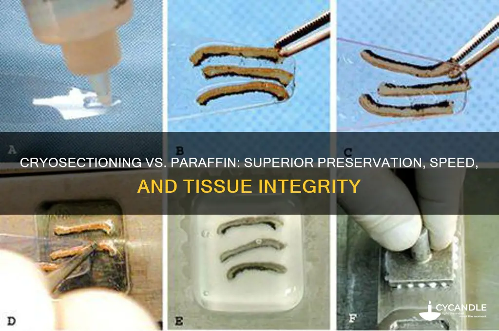why is cryosectioning better than paraffin sectioning