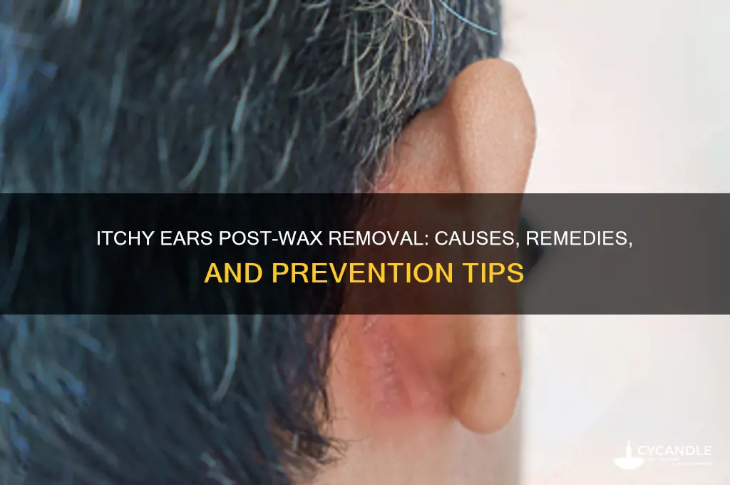 why is my ear itchy after ear wax removal