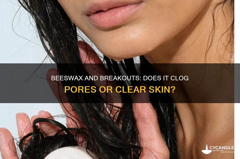 will beeswax cause breakouts