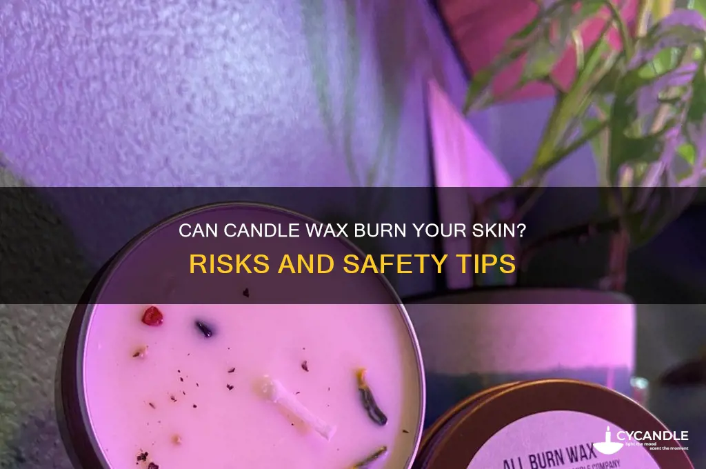 will candle wax burn skin