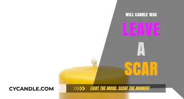 Candle Wax Burns: Will They Leave Scars or Heal Smoothly?