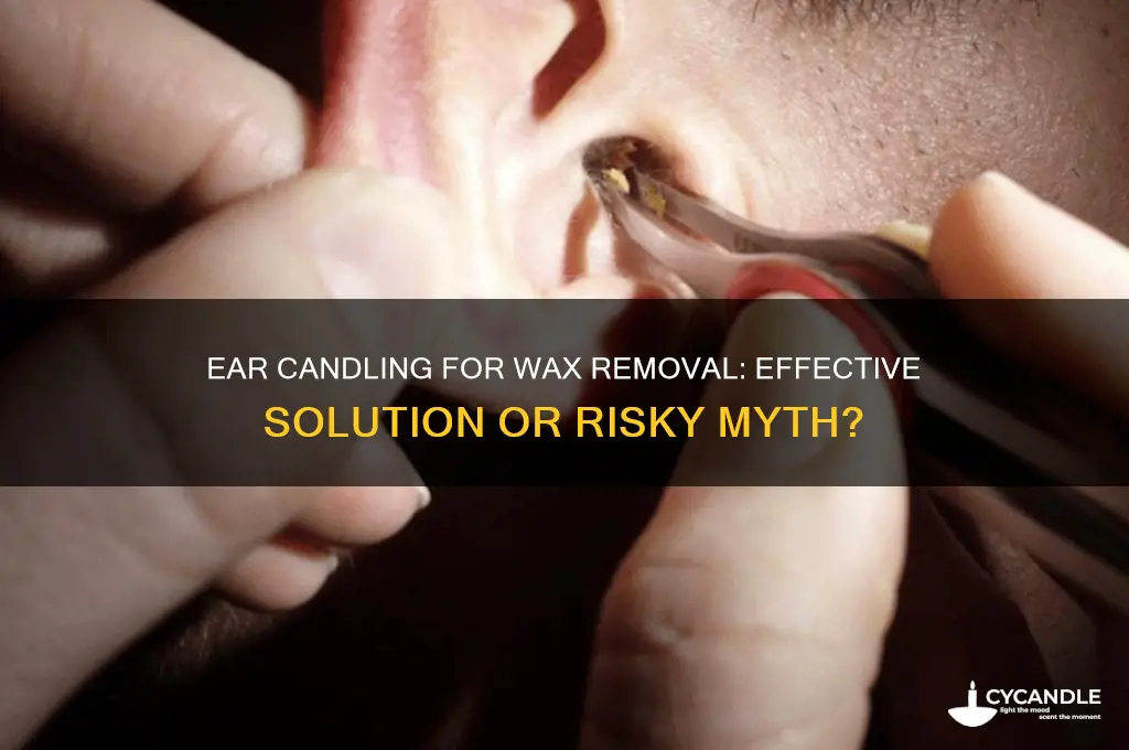will ear candles remove wax