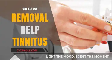 Can Ear Wax Removal Ease Tinnitus Symptoms? Expert Insights