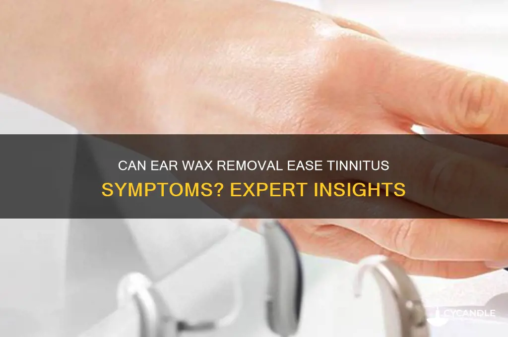 will ear wax removal help tinnitus