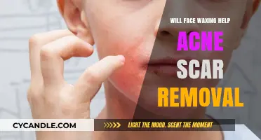 Face Waxing for Acne Scars: Effective Solution or Skin Risk?