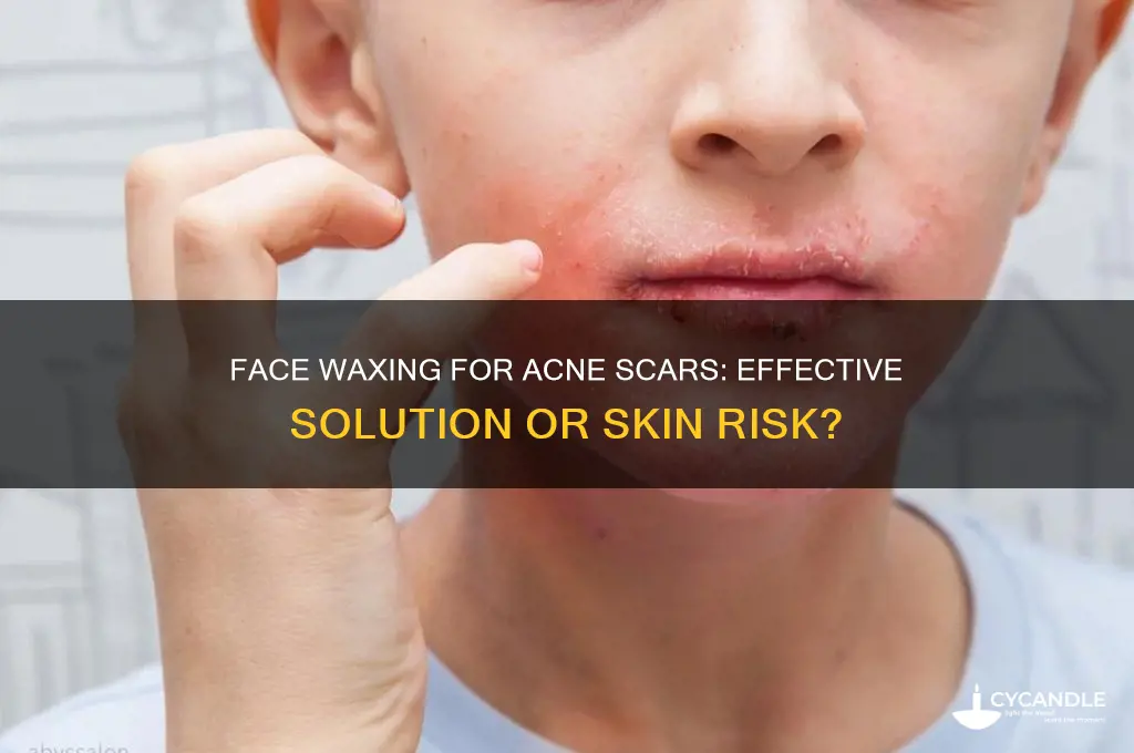 will face waxing help acne scar removal