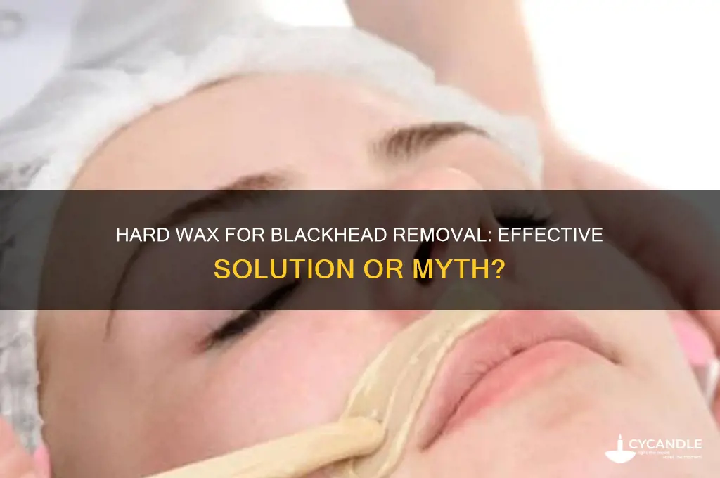 will hard wax remove blackheads