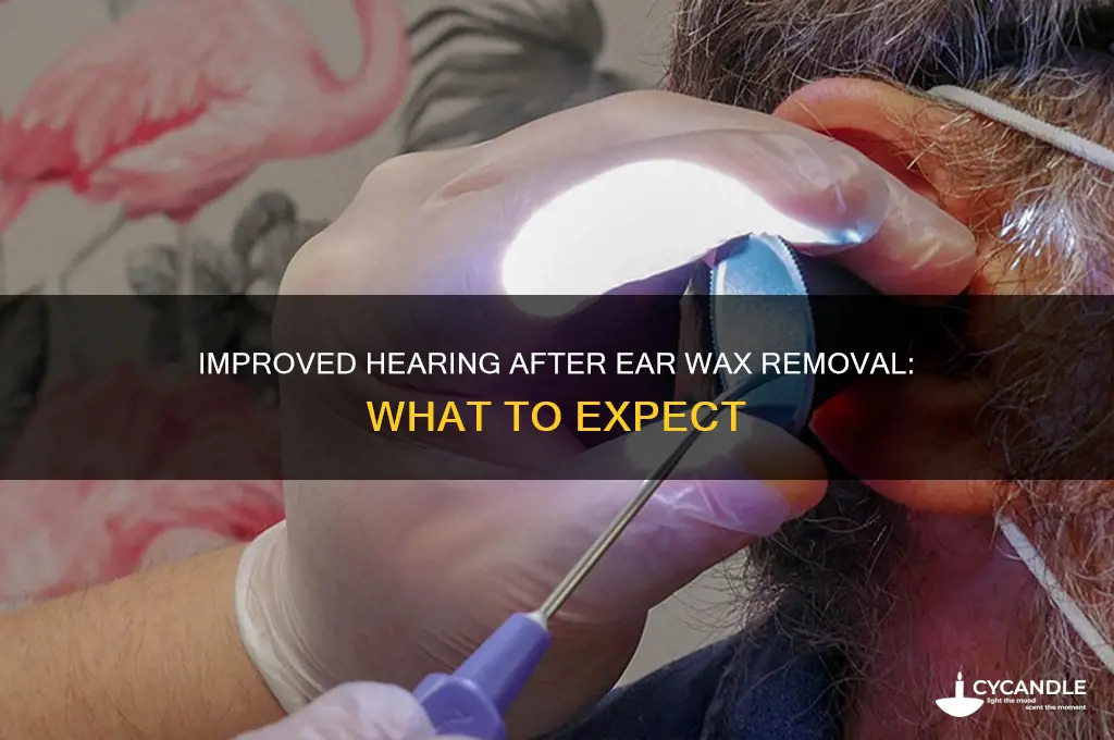 will i hear better after wax removal