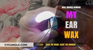 Will Kaiser Safely Remove My Ear Wax? Expert Insights and Tips