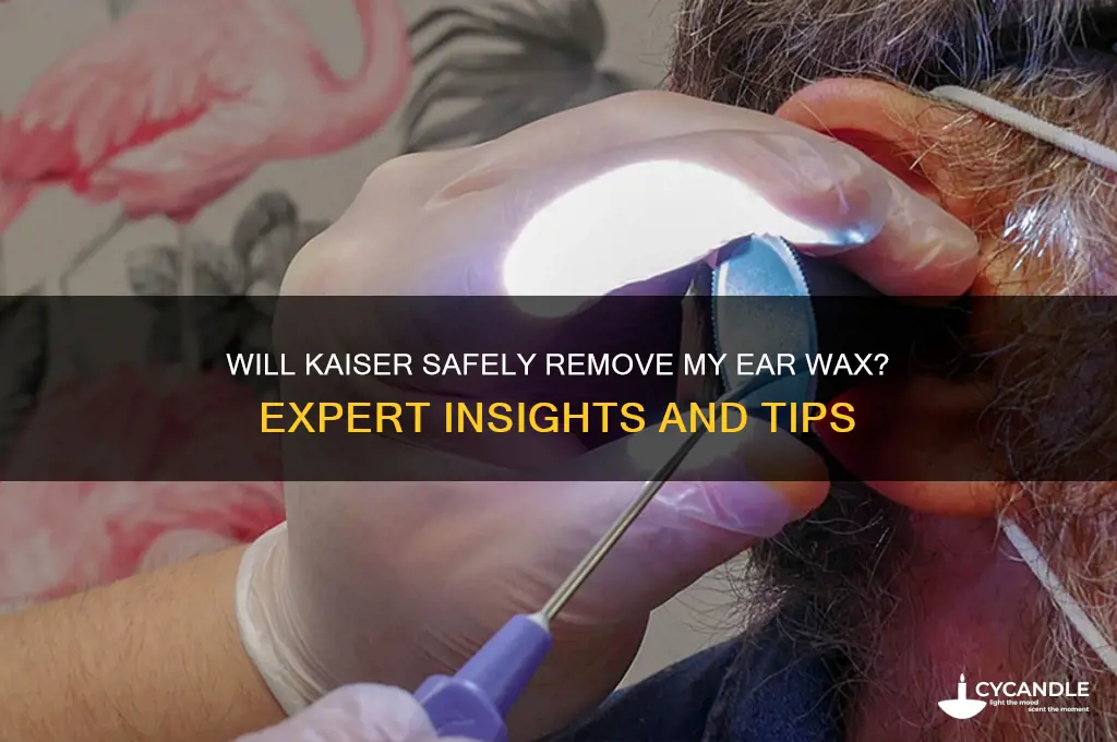 will kaiser remove my ear wax