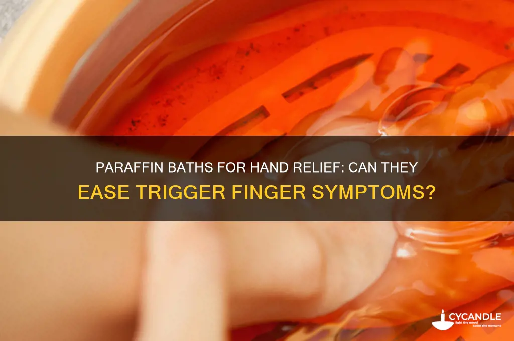 will paraffin baths of the hand benefit trigger finger