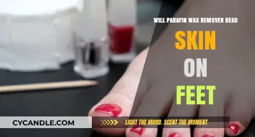 Paraffin Wax for Foot Care: Does It Remove Dead Skin Effectively?