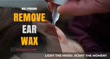 Can Hydrogen Peroxide Safely Remove Ear Wax? Expert Insights