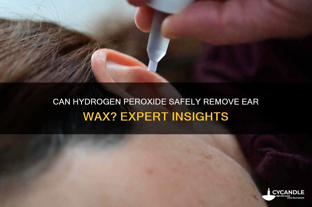 will peroxide remove ear wax