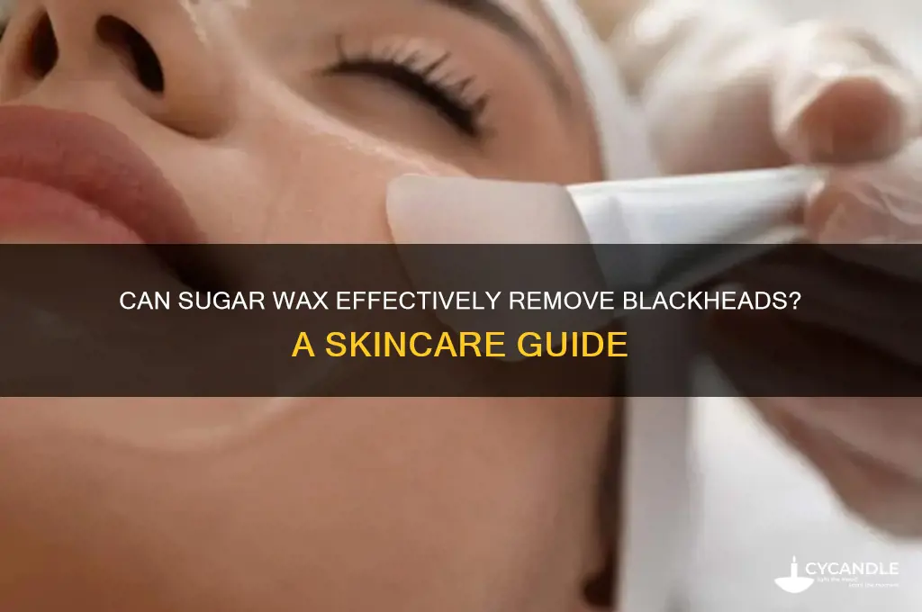will sugar wax remove blackheads