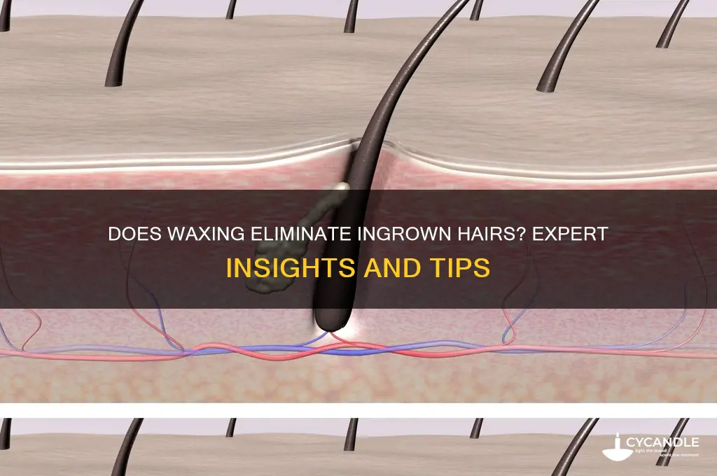 will waxing remove ingrown hairs